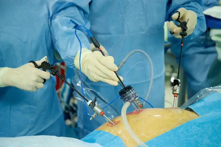 Hernia Inguinal Lap