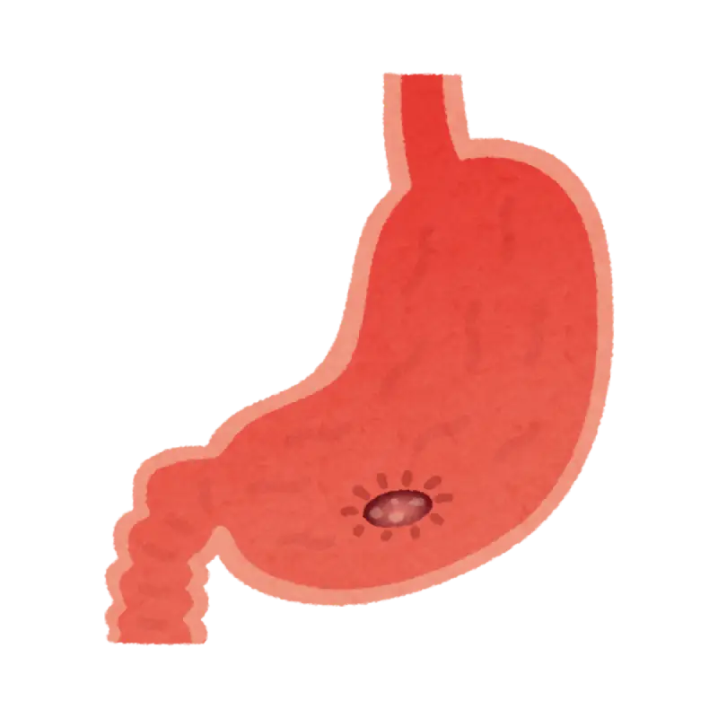 Cáncer gastrointestinal